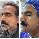 جشنواره زیبایی صورت و بدن/بدن50٪ تخفیف