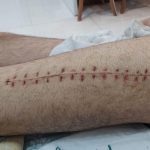 تزریقات،خدمات پرستاری،وصل سرم در منزل